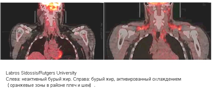 С жиру худеют. Ученые объяснили, как есть все подряд и не полнеть