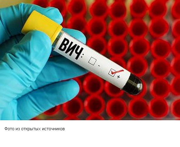 Уникальная вакцина активирует производство антител к ВИЧ