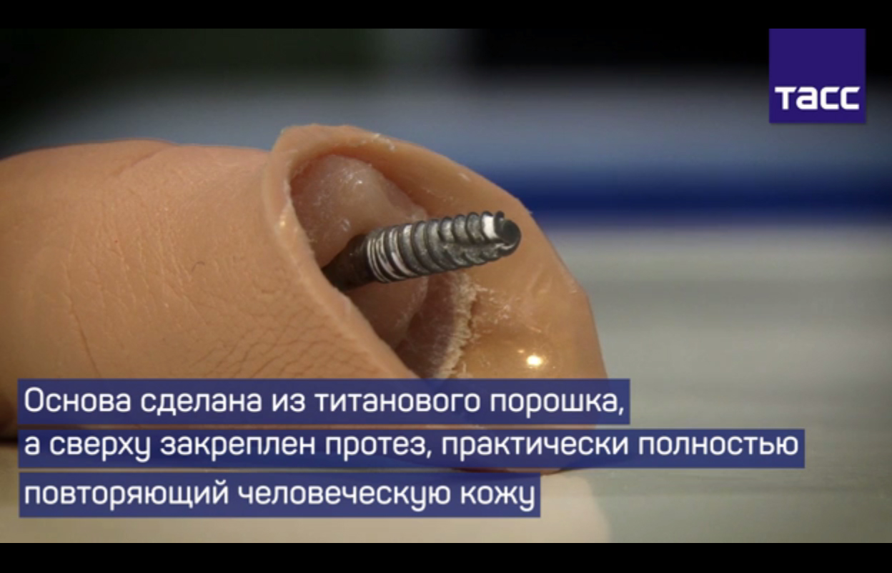 Ученые успешно завершили испытания по вживлению имплантов, распечатанных на 3D-принтере
