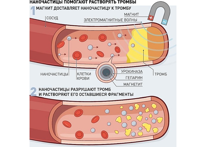 Нано наносит удар
