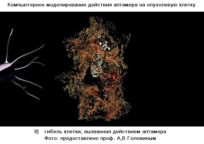 Как справиться с опухолью мозга